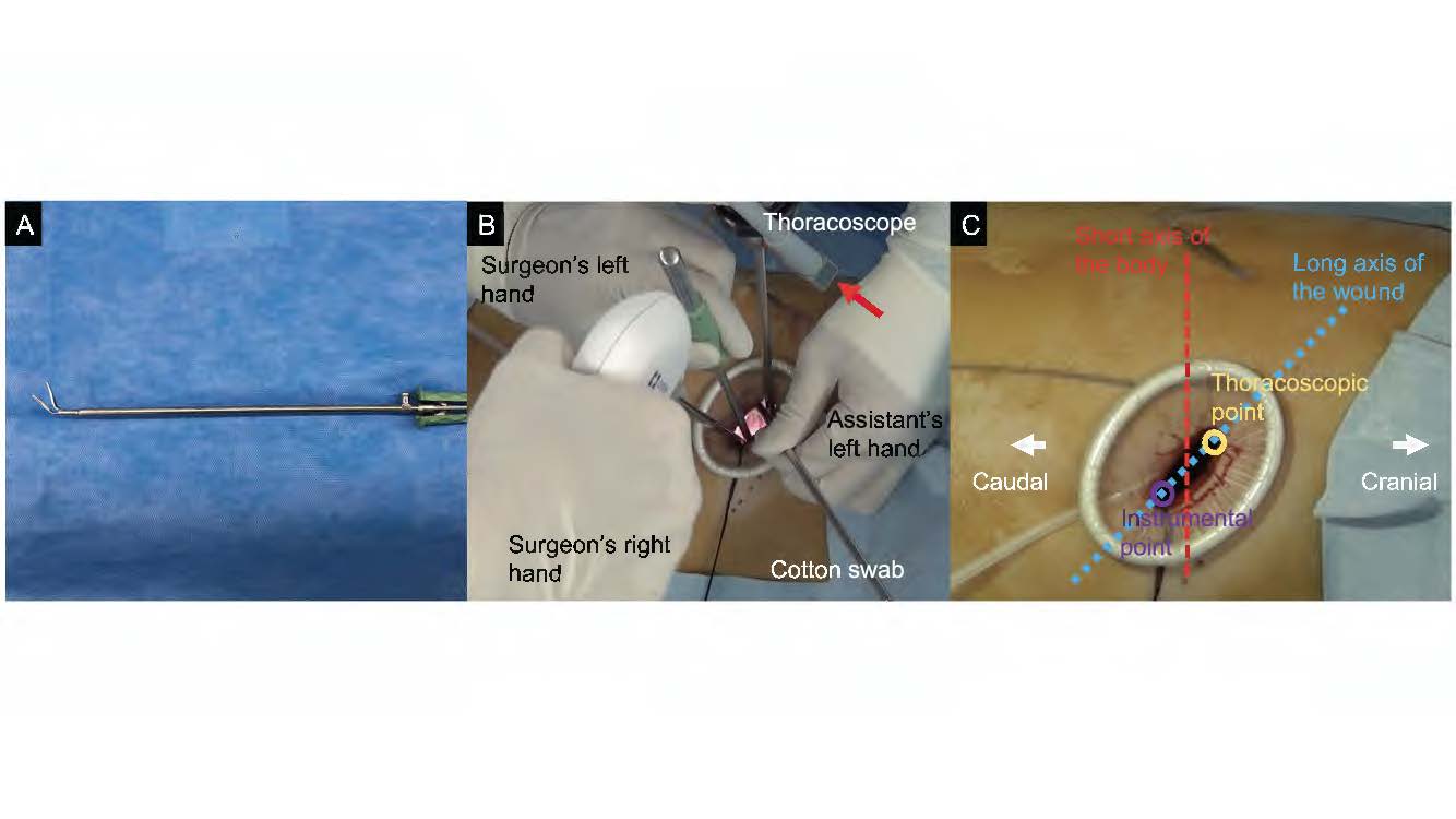 Tips for using forceps during uniportal videoassisted thoracoscopic